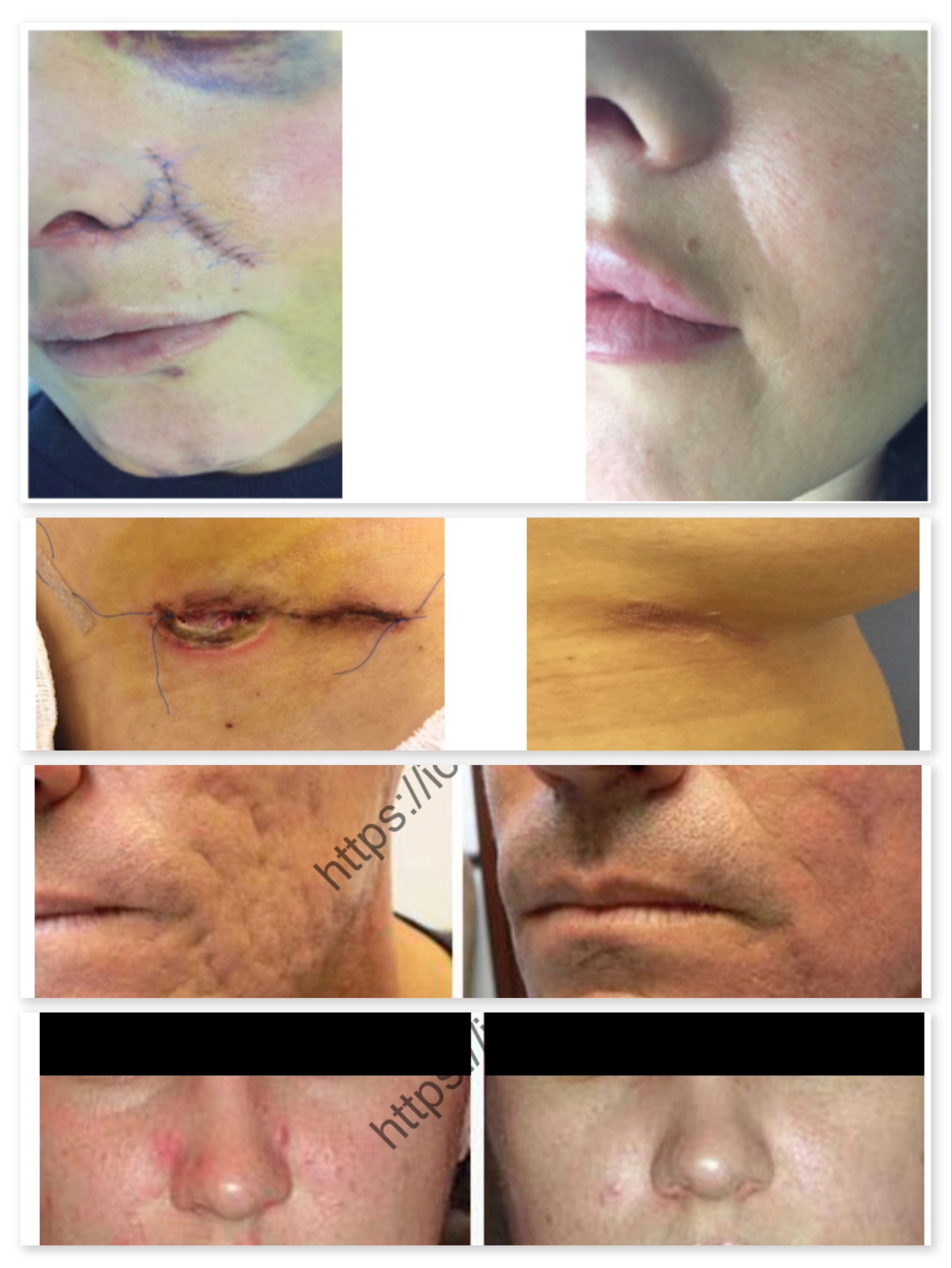 Aesthetic medicine, cosmetology and anti aging by stem cells in Moscow, Russia